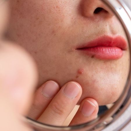 صورة للفئة علاجات البشرة