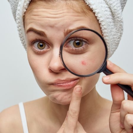 صورة للفئة حب الشباب 